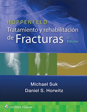 Tratamiento Rehabilitacion Fractur 2e Pb [KSIĄŻKA]
