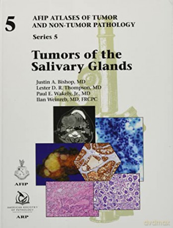 Tumors Of The Salivary Glands - Justin A. Bishop [KSIĄŻKA]
