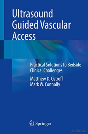 Ultrasound Guided Vascular Access - Ostroff [KSIĄŻKA]