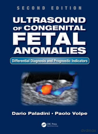 Ultrasound Of Congenital Fetal Anomalies - Dario Paladini [KSIĄŻKA]