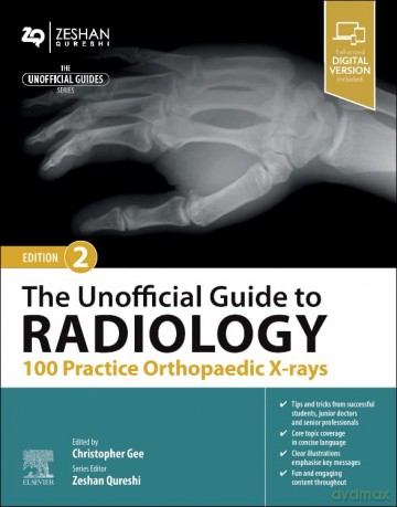 Unofficial Guide To Radiology 100 Practi - Christopher Gee [KSIĄŻKA]