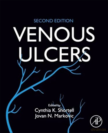 Venous Ulcers - Cynthia K. Shortell [KSIĄŻKA]