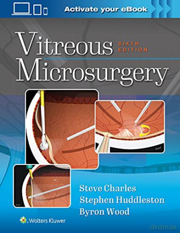 Vitreous Microsurgery 6e - Steve Charles [KSIĄŻKA]