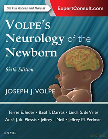 Volpes Neurology Of The Newborn - Joseph Volpe [KSIĄŻKA]
