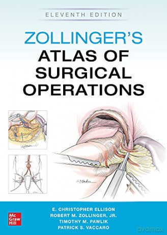 Zollingers Atlas Of Surgical Operations - Zollinger [KSIĄŻKA]