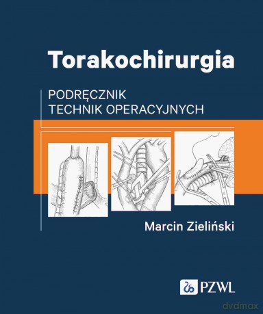 Torakochirurgia [KSIĄZKA]