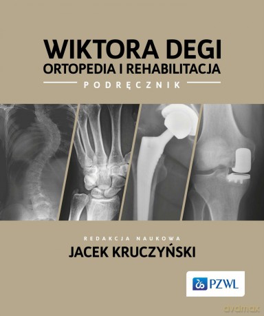 Wiktora Degi ortopedia i rehabilitacja [KSIĄZKA]