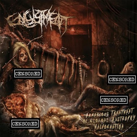 Encystment: Egregious Treatment Of Cloacal Extrophy Malformation [CD]