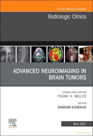 Advanced Neuroimaging In Brain Tumors An - Sangam Kanekar [KSIĄŻKA]