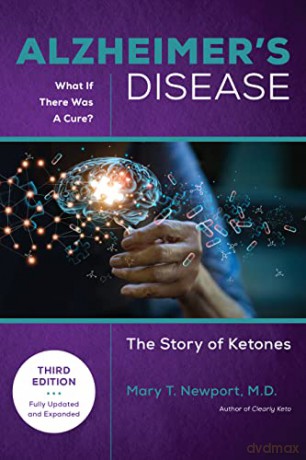 Alzheimers Disease What If There Is A [KSIĄŻKA]