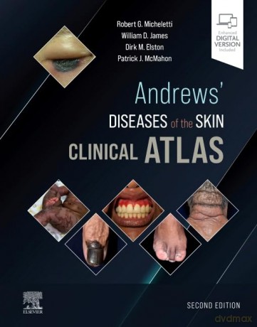Andrews Diseases Of The Skin Clinical At - William D. James [KSIĄŻKA]