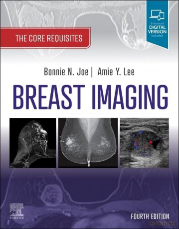 Breast Imaging - Bonnie N. Joe [KSIĄŻKA]