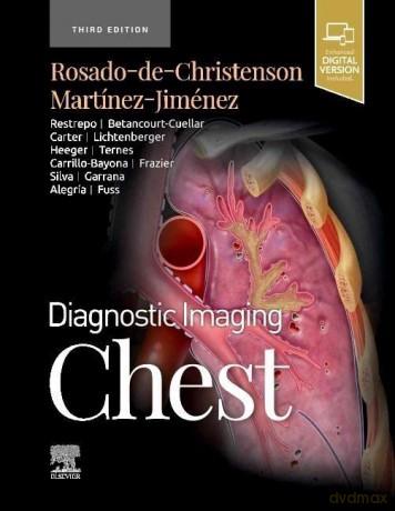 Diagnostic Imaging Chest - Rosado-De-Christenso [KSIĄŻKA]