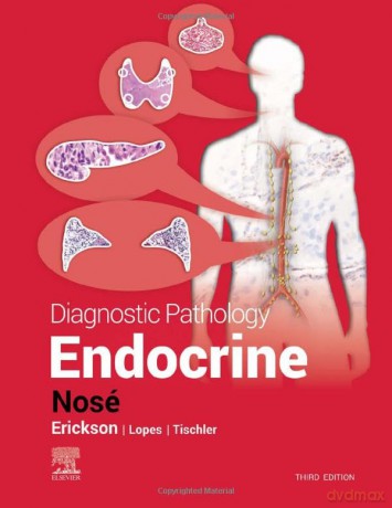 Diagnostic Pathology Endocrine - Vania Nose [KSIĄŻKA]