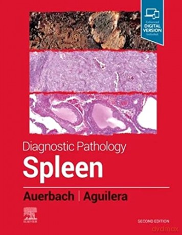 Diagnostic Pathology Spleen - Aaron Auerbach [KSIĄŻKA]