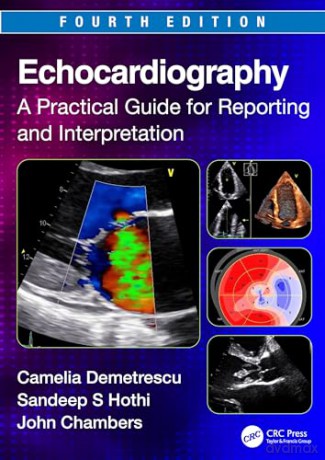 Echocardiography - John Chambers [KSIĄŻKA]