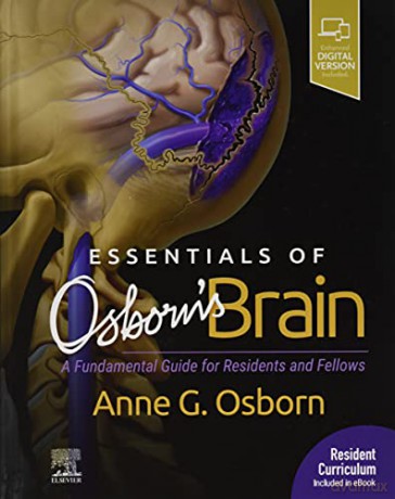 Essentials Of Osborns Brain A Fundamenta - Anne Osborn [KSIĄŻKA]