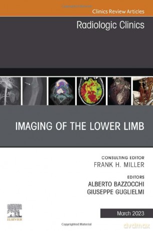 Imaging Of The Lower Limb An Issue Of Ra - Alberto Bazzocchi [KSIĄŻKA]
