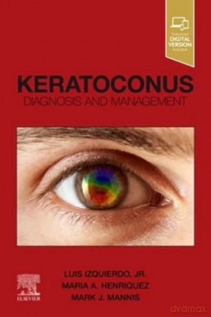 Keratoconus - Luis Izquierdo [KSIĄŻKA]
