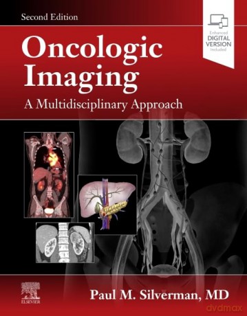 Oncologic Imaging A Multidisciplinary Ap - Paul Md Silverman [KSIĄŻKA]