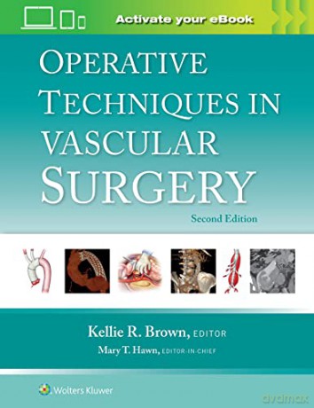 Operative Tech Vascular Surgery 2e - Kellie R Brown [KSIĄŻKA]