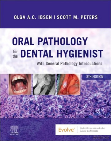 Oral Pathology For The Dental Hygienist - Olga A. C. Ibsen [KSIĄŻKA]