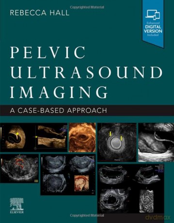 Pelvic Ultrasound Imaging - Rebecca Hall [KSIĄŻKA]