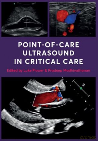 Point Of Care Ultrasound In Critical Ca [KSIĄŻKA]