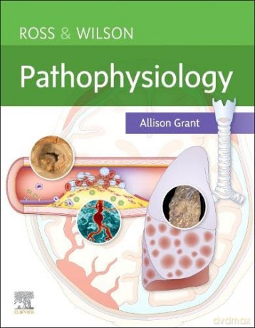 Ross Wilson Pathophysiology - Allison Grant [KSIĄŻKA]