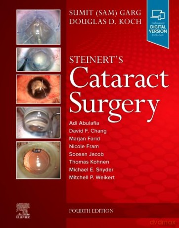 Steinerts Cataract Surgery - Sumit Garg [KSIĄŻKA]