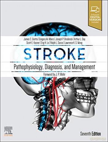 Stroke - James C. Grotta [KSIĄŻKA]
