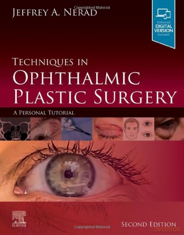 Techniques In Ophthalmic Plastic Surgery - Jeffrey A. Nerad [KSIĄŻKA]