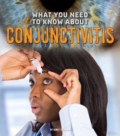 What You Need To Know About Conjunctivit - Nancy Dickmann [KSIĄŻKA]