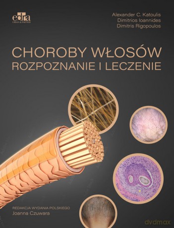 Choroby włosów. Rozpoznanie i leczenie - Katoulis Alexander C., Dimitris Rigopoulos [KSIĄŻKA]
