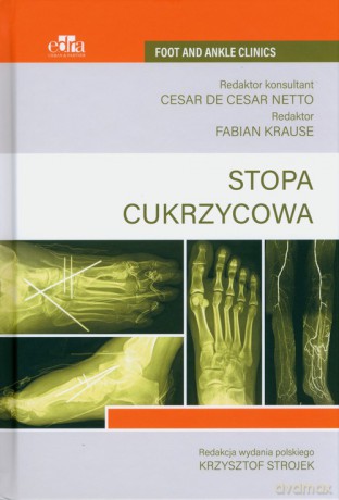 Stopa cukrzycowa [KSIĄŻKA]
