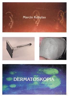 Dermatoskopia - Marcin Kobylas [KSIĄŻKA]
