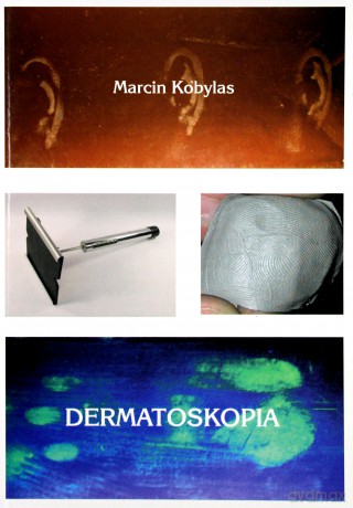 Dermatoskopia - Marcin Kobylas [KSIĄŻKA]