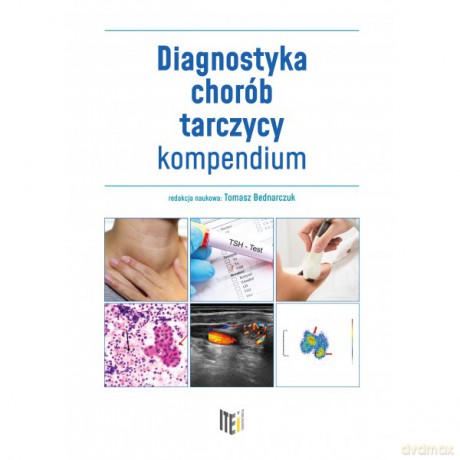 Diagnostyka chorób tarczycy - kompendium - Tomasz Bednarczuk [KSIĄŻKA]