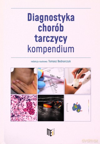 Diagnostyka chorób tarczycy - kompendium - Tomasz Bednarczuk [KSIĄŻKA]