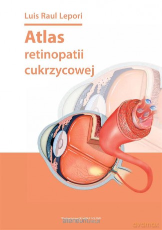 Atlas retinopatii cukrzycowej - Louis Raul Lepori [KSIĄŻKA]