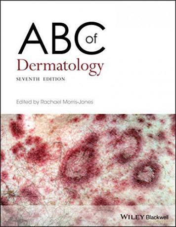 Abc Of Dermatology - Rachae Morris-Jones [KSIĄŻKA]