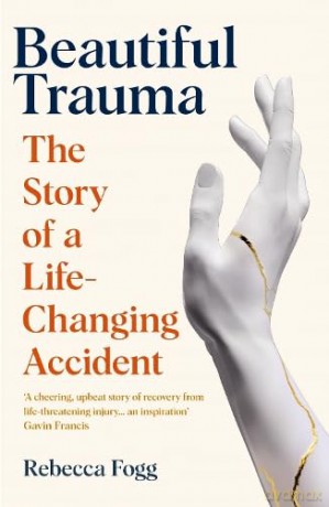 Beautiful Trauma - Rebecca Fogg [KSIĄŻKA]