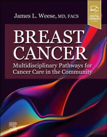 Breast Cancer - ames L. Weese [KSIĄŻKA]
