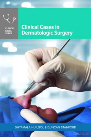 Clinical Cases In Dermatologic Surgery [KSIĄŻKA]
