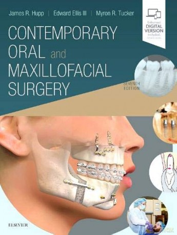 Contemporary Oral And Maxillofacial Sur [KSIĄŻKA]