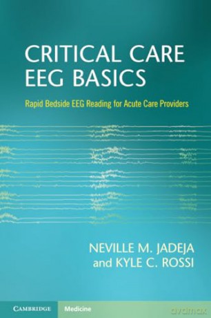 Critical Care Eeg Basics - Jadeja Neville M. [KSIĄŻKA]