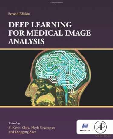 Deep Learning for Medical Image Analysis (The MICCAI Society book Series) [KSIĄŻKA]