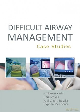 Difficult Airway Management Case Stud - Ambreen Yasin Mbbs B [KSIĄŻKA]