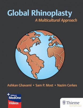 Global Rhinoplasty - Ashkan Ghavami [KSIĄŻKA]