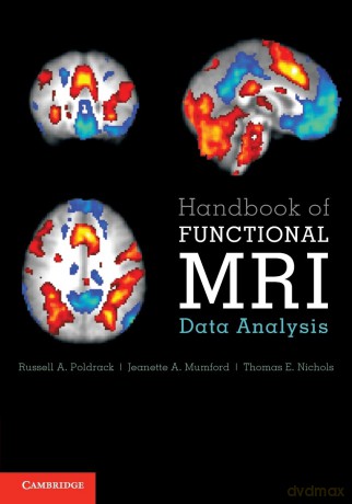 Handbook Of Functional Mri Data Analysi - Poldrack Russell A. [KSIĄŻKA]